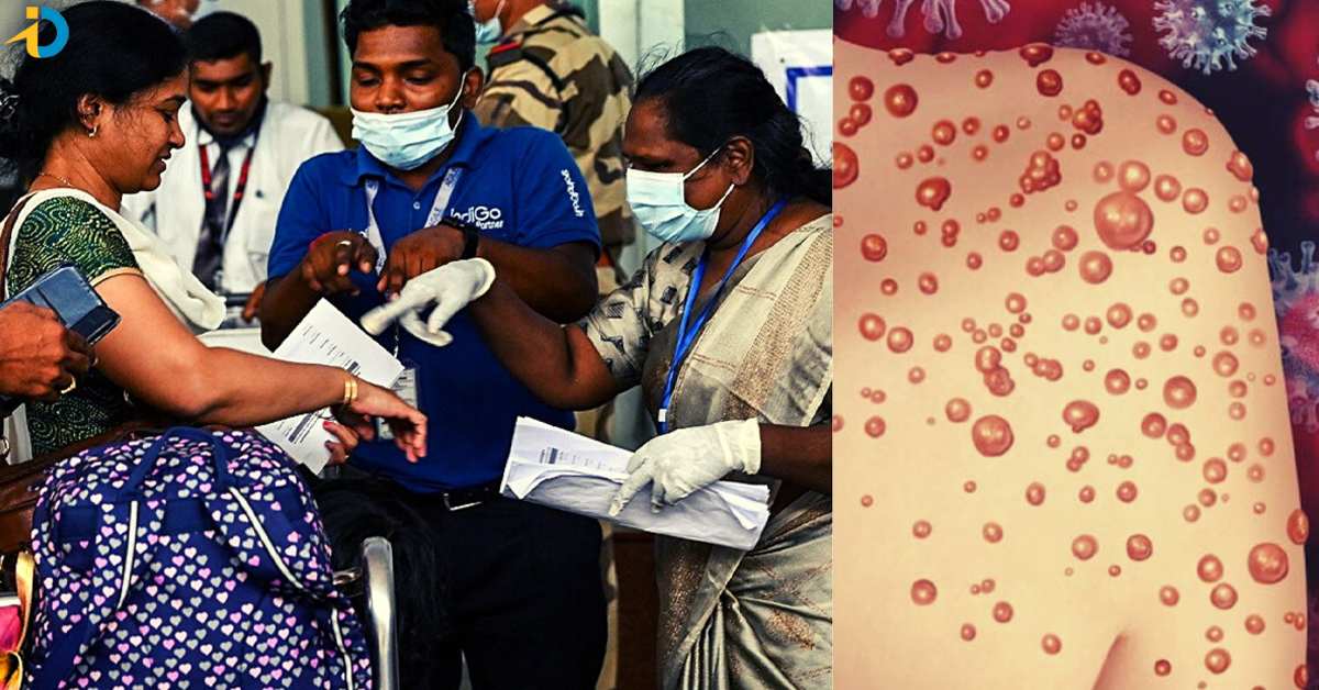 India’s First Monkeypox Death : దేశంలో మంకీపాక్స్ తొలి మ‌ర‌ణం, కేంద్రం కీలక నిర్ణయం