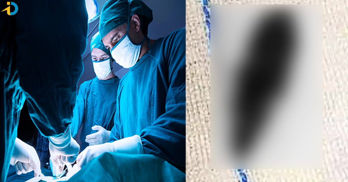 వైద్యుల అద్భుతం.. 11 ఏళ్ల తర్వాత తల నుంచి బుల్లెట్..