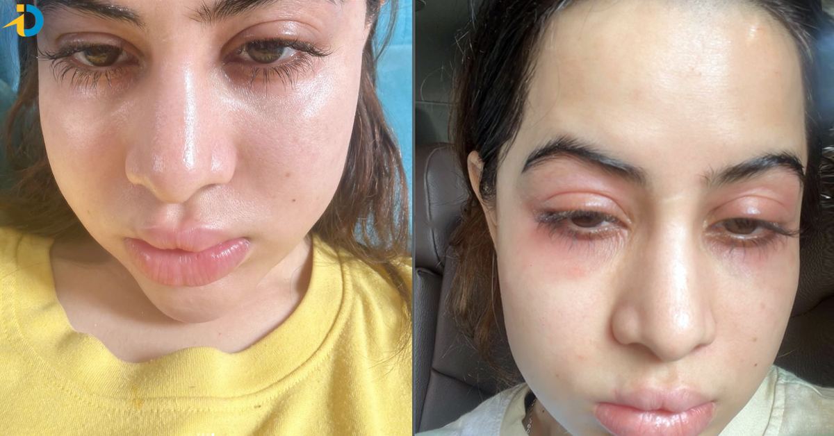 Bigg Boss beauty suffering from health problem 02