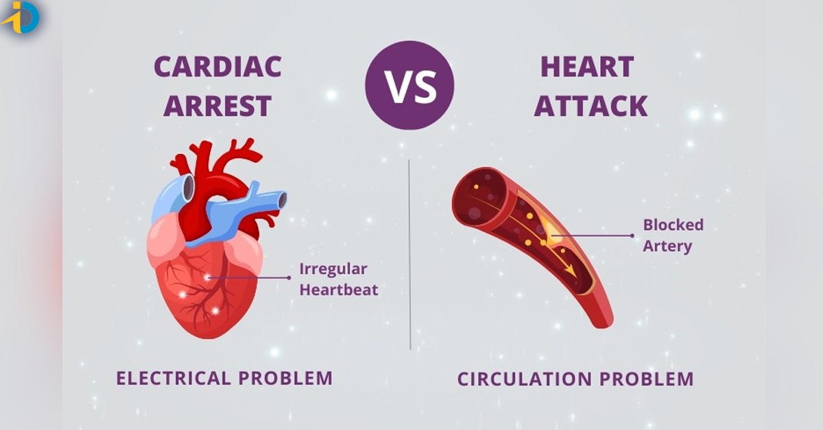 heart attack