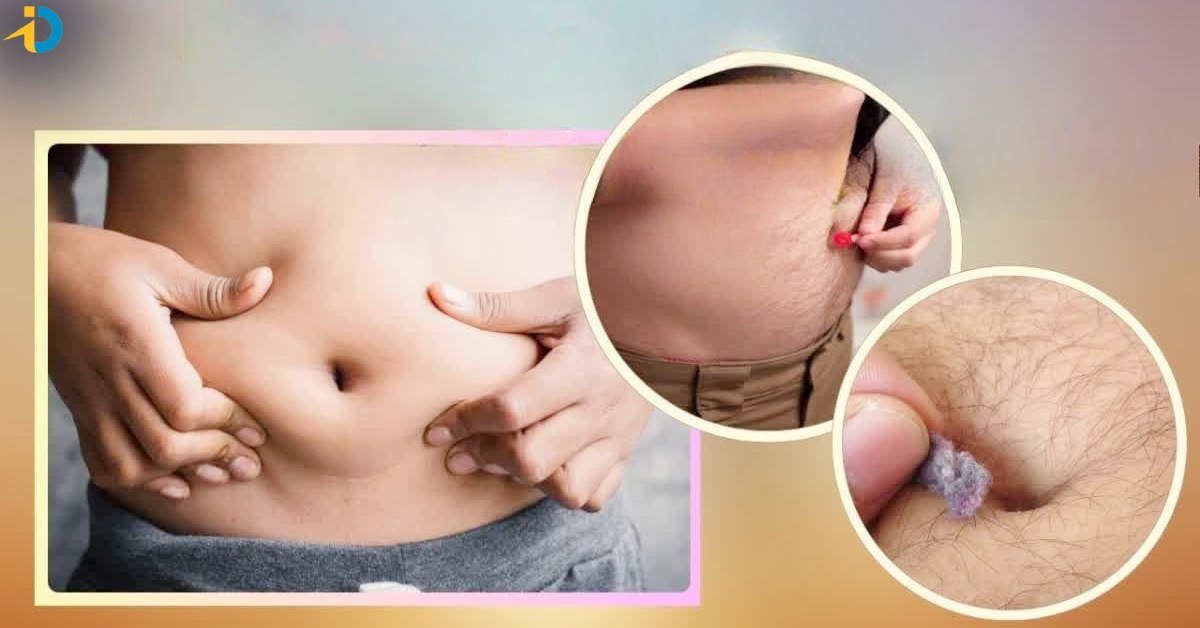 Belly: మీ బొడ్డులో దూది ఏర్పడుతుందా? ఇక అంతే సంగతులు!